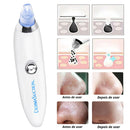 Removedor de Cravos a Vácuo Sem Fio - Limpeza Profunda e Cuidados com a Pele