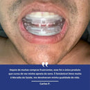 Protetor Bucal Anti-Ronco e Bruxismo